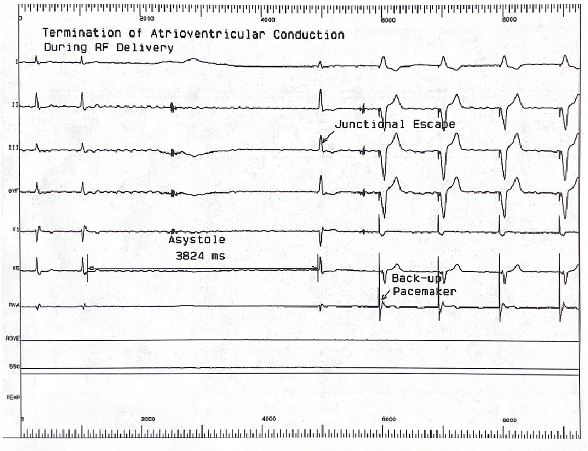 ChartAcademy's tweet image. 💥Join the yearly GROW membership BEFORE11/30-FREE-ExPloring EP course Feb &apos;26!
📆 link in bio!

🎒 EP Study
1. AVN RFA with ppm provides which of the following:
1. rate control
2. rate regularity
3. rate responsiveness
4. all of the above

#CHARTpeeps #EPeeps #VivaEP #CHARTEPPro