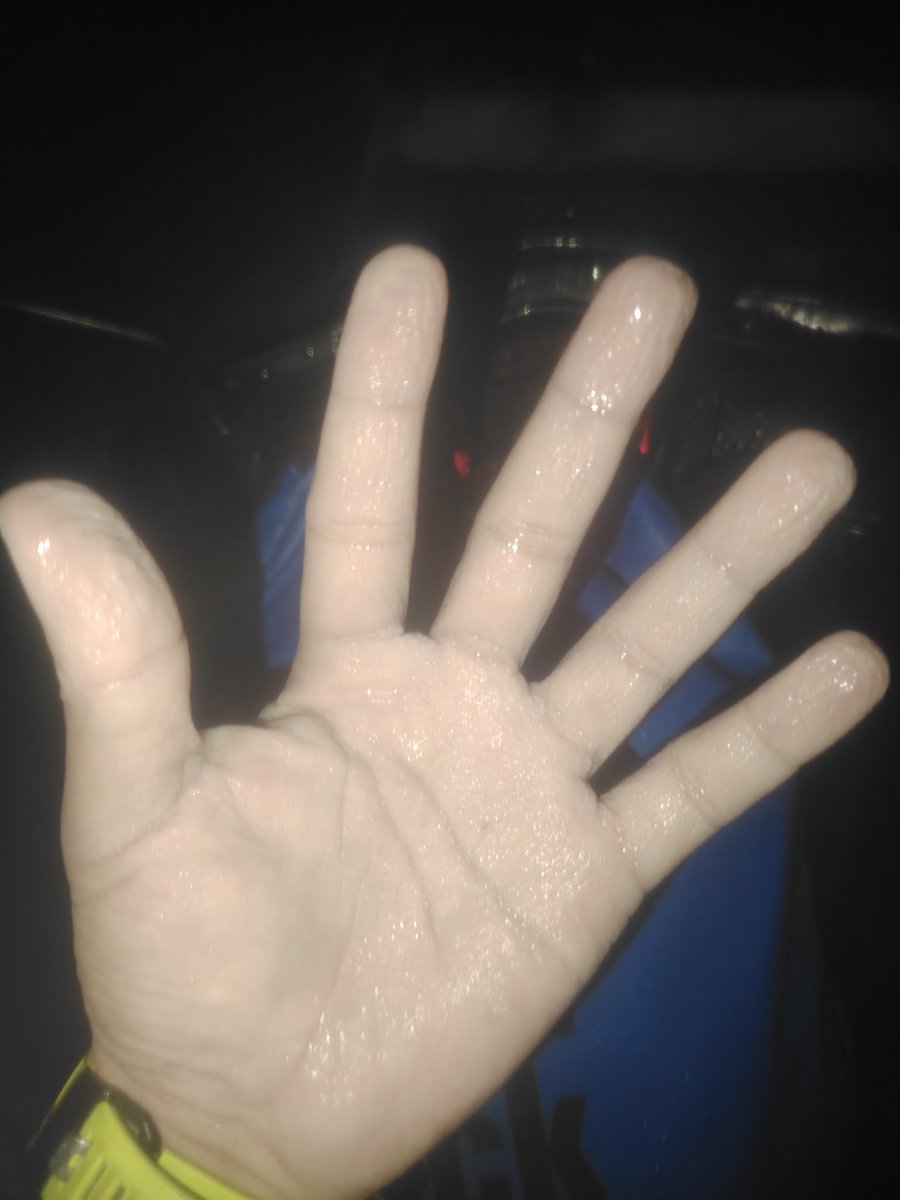 azm_ftr's tweet photo. Hasil meredah, sejuk sampai ke tulang https://t.co/tBfcIXJG6r
