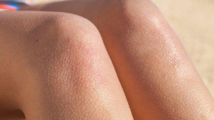 Raaaaaa☄️ tweet media