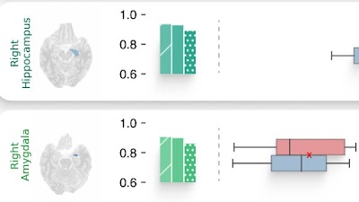 Radiology_AI's tweet image. 🚀 Introducing #DLMUSE: a deep learning model for brain MRI segmentation that’s 10,000x faster than traditional methods! ⏱️ Segments in just 3.5 seconds with state-of-the-art accuracy doi.org/10.1148/ryai.2… @Penn #MRI #segmentation #ML