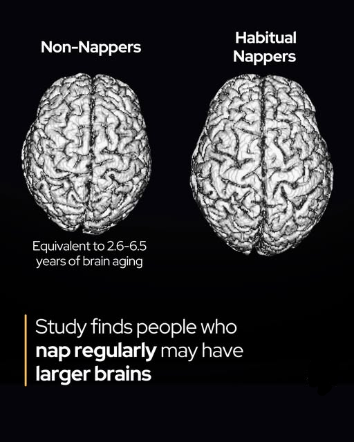 Rainmaker1973's tweet image. Skip your daily nap, shrink your brain.

A study by researchers from University College London and the University of the Republic in Uruguay has found that people who habitually take daytime naps tend to have significantly larger total brain volume—a key indicator of brain health…