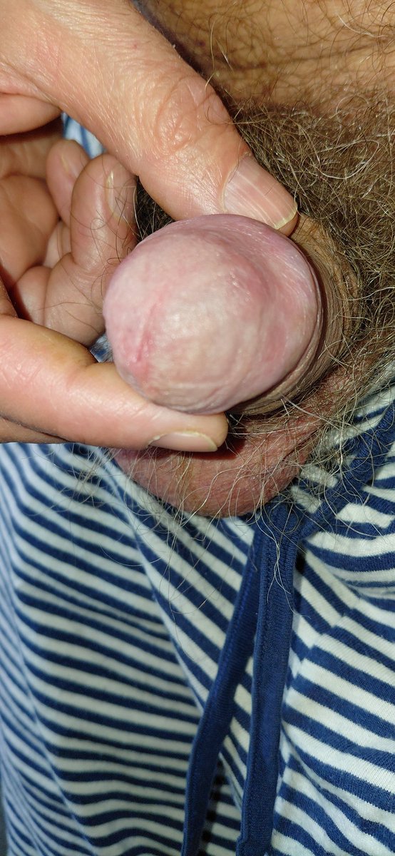 Gierige haariger Schlappschwanz will öffentlich zeigen.