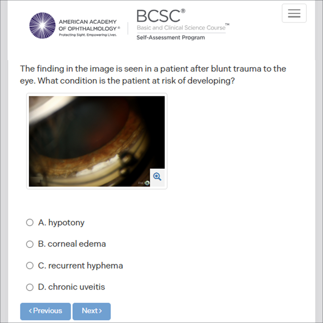 aao_ophth's tweet image. Subscribe to the Academy’s question bank. The #BCSC Self-Assessment Program can help with #OKAP prep and earning self-assessment #CME credits. Answer: A ow.ly/8uSY50Xo709