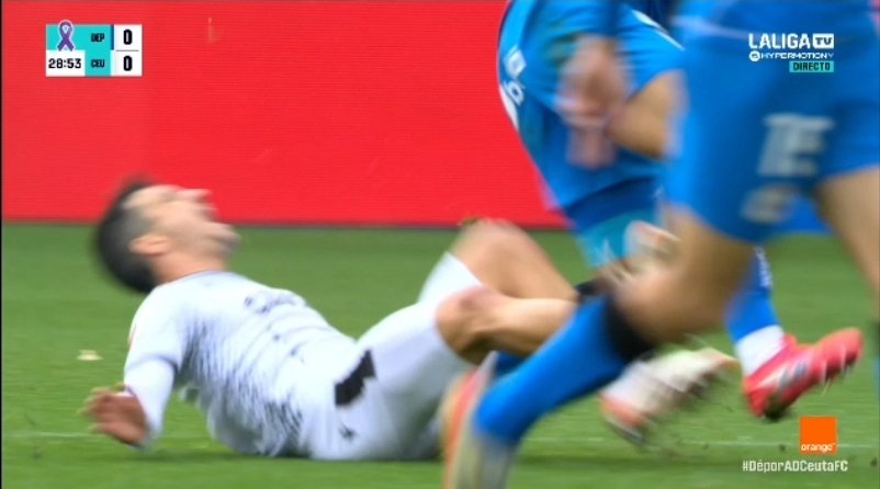 MrAsubio's tweet image. #Dépor #Ceuta

👟 Balón dividido entre Noubi e Martos onde o deportivista pisa e acaba raspando a Matos.

📌 XOGADA MOI GRIS TAMÉN ESTA, VÉXOA MÁIS DE 🟨 QUE 🟥.

▪️Impacto de cheo e con forza = 🟥
▪️Raspada = 🟨

👮🏻‍♂️:✅️
📺:✅️

▪️Tiro máis pola 🟨 ao non ver forza excesiva...