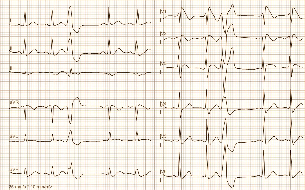 Dr. Andreas Roeschl tweet media