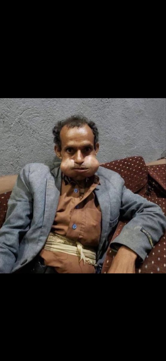 <a href="/Malclom20/">Mr. Mark</a> ليش متوتر
فضيحتك قويه صح
للآن في مرحلة الصدمه؟

خذلك تخزينة قات وروق
الدنيا سهالات
مو اول واحد يتم قرعه بالنعال
حتى يمنك التعيس نبذك !

انت مشرد من نوع فاخر 🙂

مستر كاك