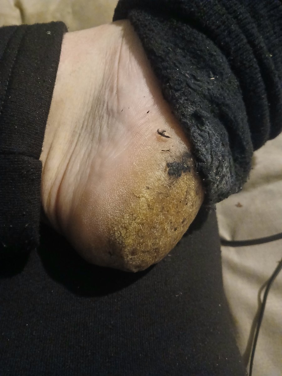 lordjon369's tweet photo. Fan service for the foot freaks. Sniff your screen. https://t.co/t9EoHhNEVh
