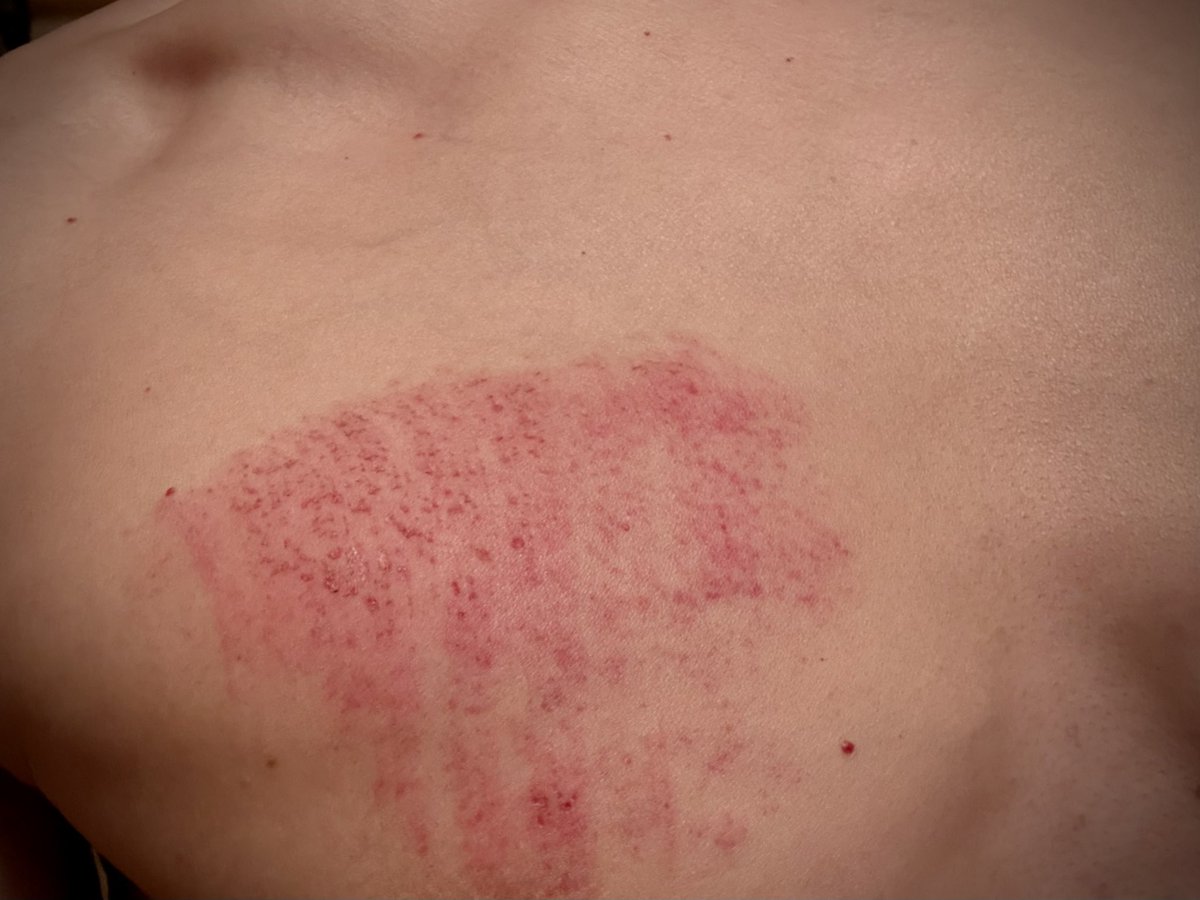 しかし…
パンチの擦り傷って何でこんなに痛いんだろうな…
今日のやらかし