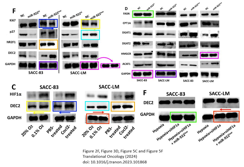 Thatsregrettab1's tweet image. Oopsies. 

A 2024(!) travesty of a paper courtesy of @ElsevierConnect&apos;s Translational Oncology journal and researchers in China.

pubpeer.com/publications/7…