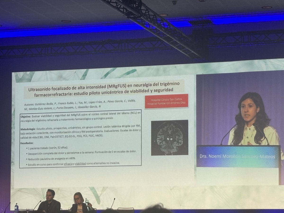 Ultrasonido focalizado en neuralgia del trigémino refractaria