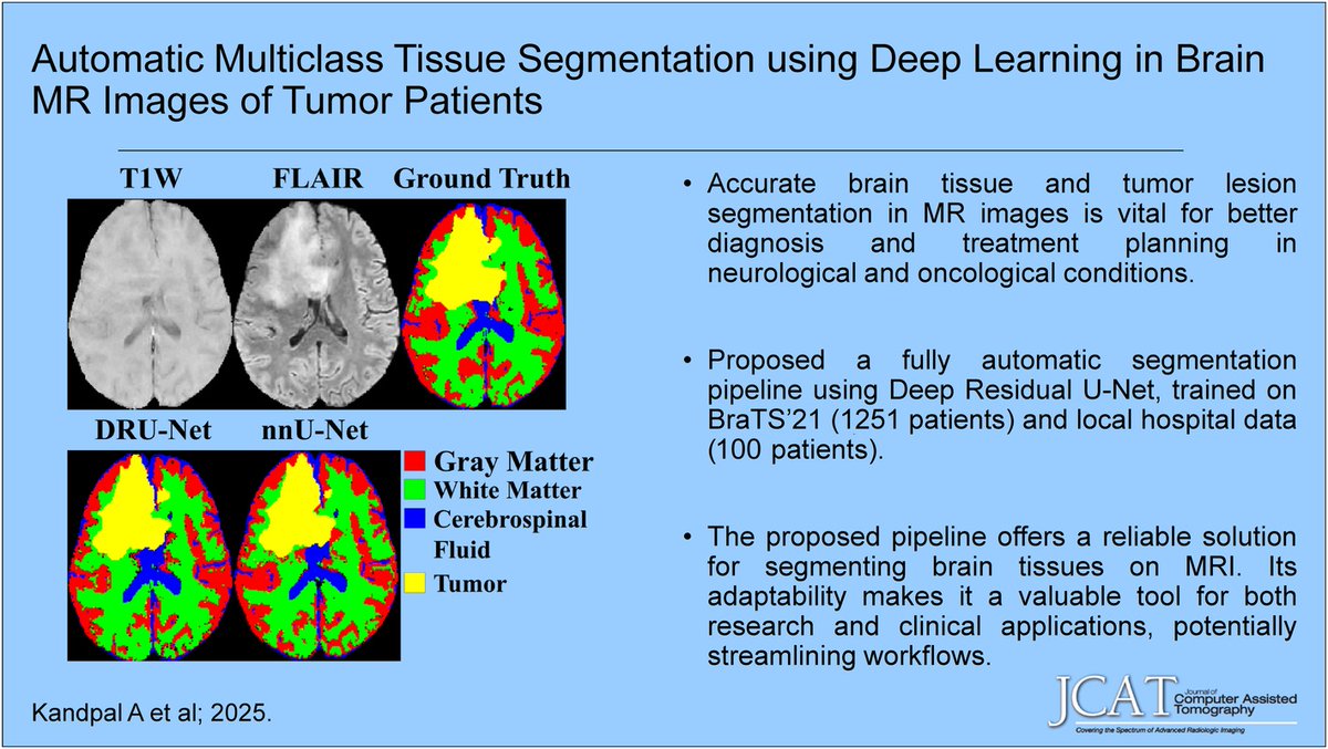ETammMD's tweet image. &quot;New @JCATonline
&apos;Automatic Multiclass Tissue Segmentation Using Deep Learning in Brain MR Images of Tumor Patients&apos;
Nov/Dec 25 tinyurl.com/453a6yet Au: Ankit Kandpal et al.  
#Segmentation #MR #brain