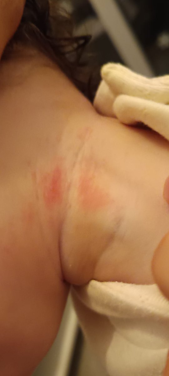 Lini7Jose's tweet photo. Hola @DecathlonEspana @Decathlon @MSocialGob @consumcat Compré esta térmica para bebés y la zona amarilla, donde están los clips de cierre, tiene todo el contorno levantado y duro como si fuese una lija sollando el cuello de mi hija. Creo que debéis replantearos su ergonomía... https://t.co/J07bI6hRhc