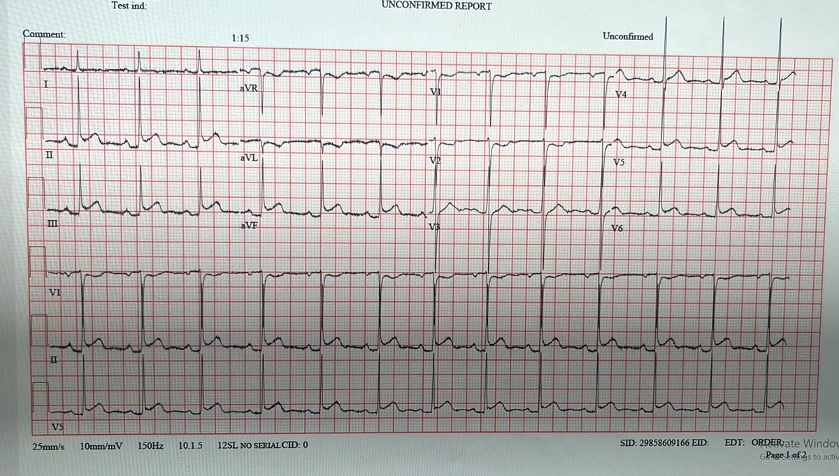MubarakAlhatemi's tweet image. 27 years old male with chest pain.
Next step?