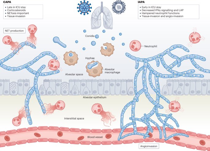 Aspergillus fumigatus biology, immunopathogenicity and drug resistance | Nature Reviews Microbiology

(nature.com/articles/s4157…)