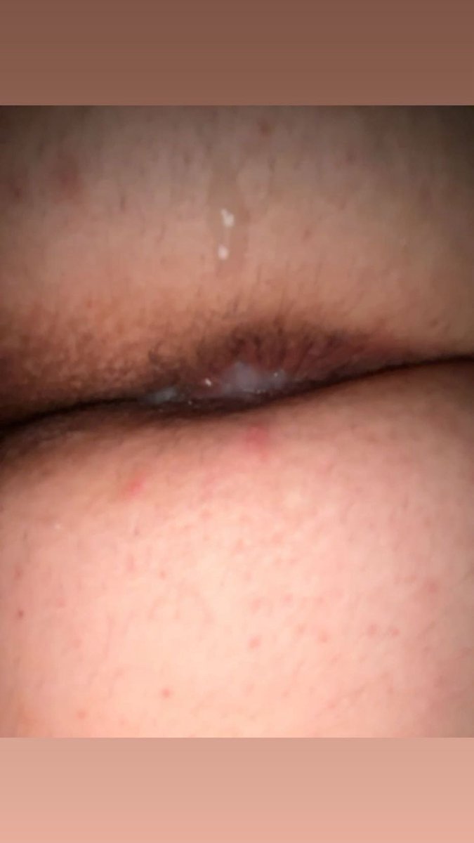 ·̩̩̥͙＊*•̩̩͙✩•̩̩͙*fruittyberrie ·̩̩̥͙•̩̩͙*˚ ˋ°•*⁀➷ tweet media