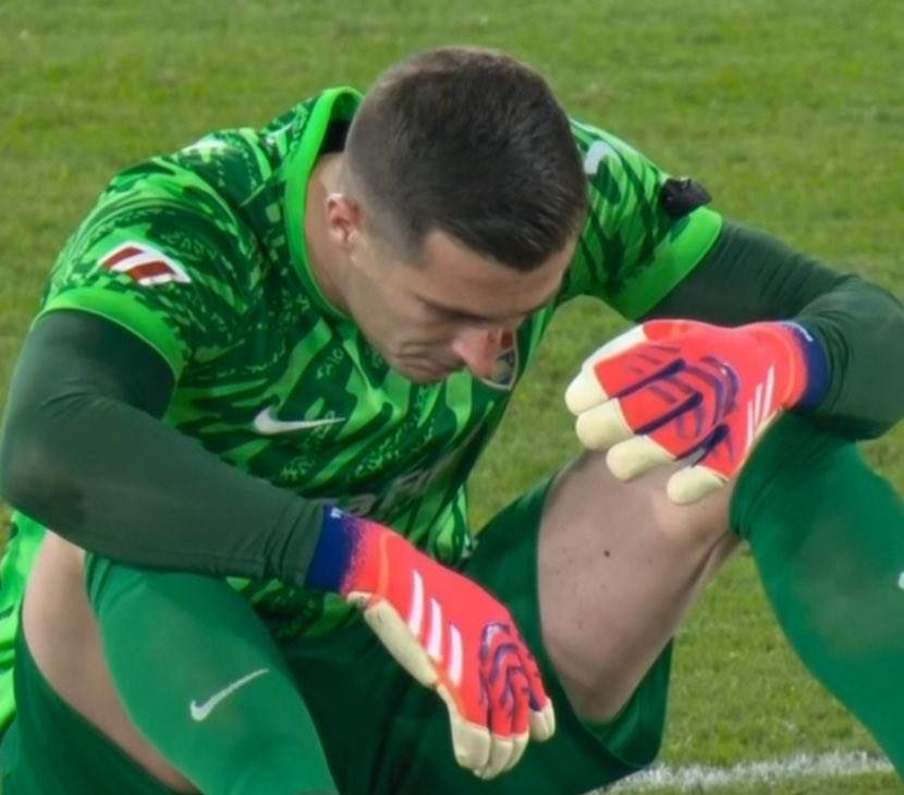 - El empate a 1 después de mano de Bellingham.

- El empate a 2 después de que Vinicius haya dejado sangrando al portero (Iñaki Peña) y después de una falta que no era.

Así ha rescatado el Madrid 1 punto en Elche.