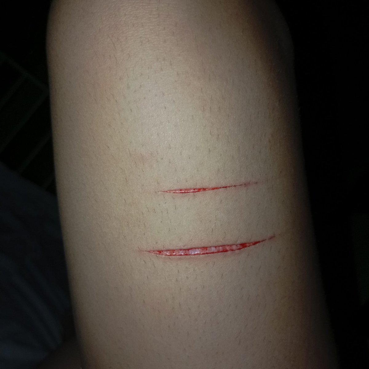imgoinginsanejs's tweet photo. RE POSTING THIS BC IT GOT TAKEN DOWN ToT Ignore my whale ass thigh, can't believe I went this shallow tf #shtwt #shadowbanned https://t.co/YMdwAQmEXs