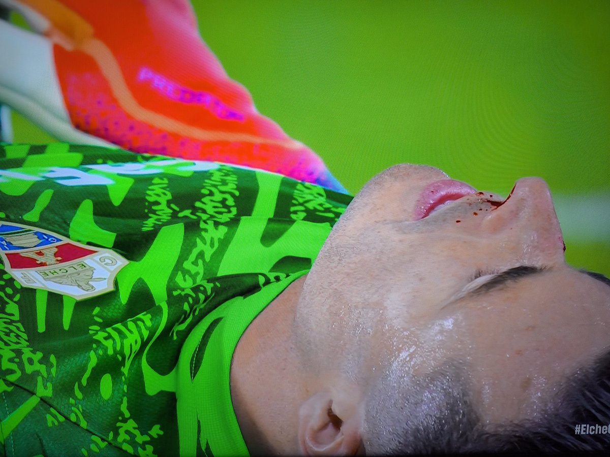 Así han dejado a Iñaki Peña en la acción del gol del 2-2.

Pero bienvenidos a la mugrienta liga Negreira 🎪🤡