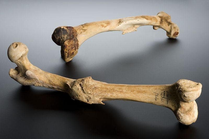 iMuthuVignesh's tweet image. The first sign of civilization isn’t tools or weapons. It’s a healed broken femur. It means someone cared, protected, and stayed. Compassion is humanity’s oldest technology.
#HumanityFirst  #Compassion  #PeopleMatter  #History  #Kindness  #Culture