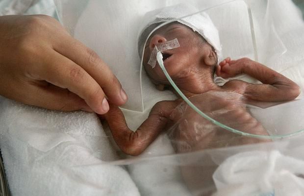 LifeNewsHQ's tweet image. Baby Born Alive at 23 Weeks Gasped for Air. Abortion Clinic Threw the Baby in a Biohazard Bag buff.ly/ioLviUV