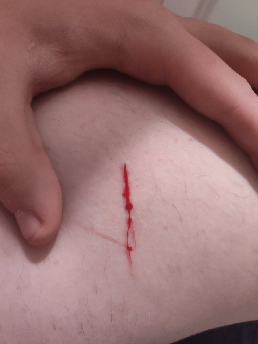 Yamazakura ✧ shtwt ⁠✧ tweet media