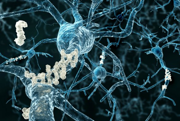 MarioNawfal's tweet image. ALZHEIMER’S BREAKTHROUGH: BRAIN’S “VACUUM CELLS” CAN CLEAR PLAQUES, RESTORE MEMORY

Scientists just discovered that boosting a single protein - Sox9 - can turn brain cells called astrocytes into full-blown amyloid-clearing machines after cognitive decline has already started.

In…