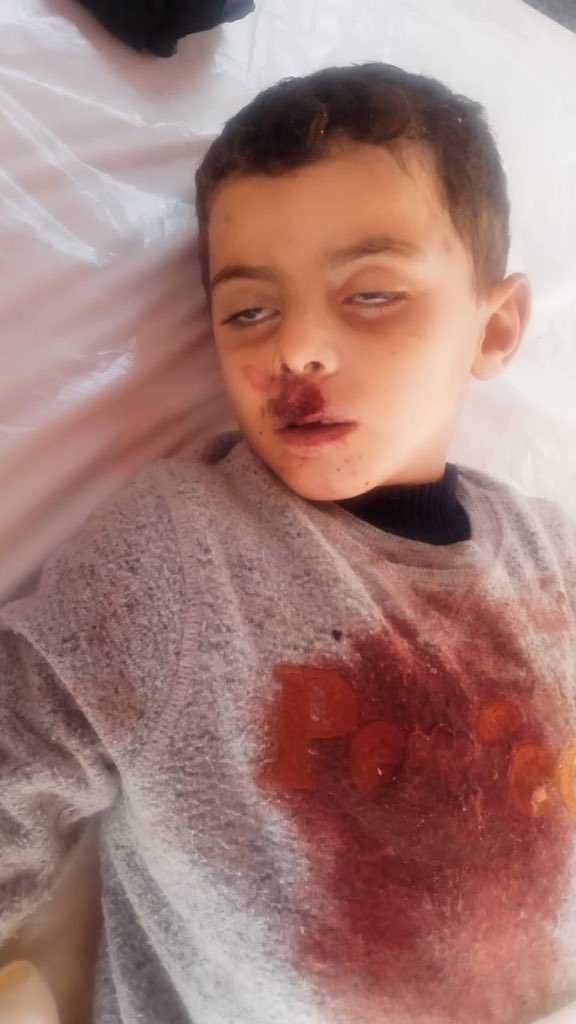 AbujomaaGaza's tweet image. Israeli violations of Trump’s ceasefire in Gaza:

▪️342 killed in Israeli military attacks 
▪️875 wounded in Israeli military attacks
▪️35 kidnapped by the Israeli military