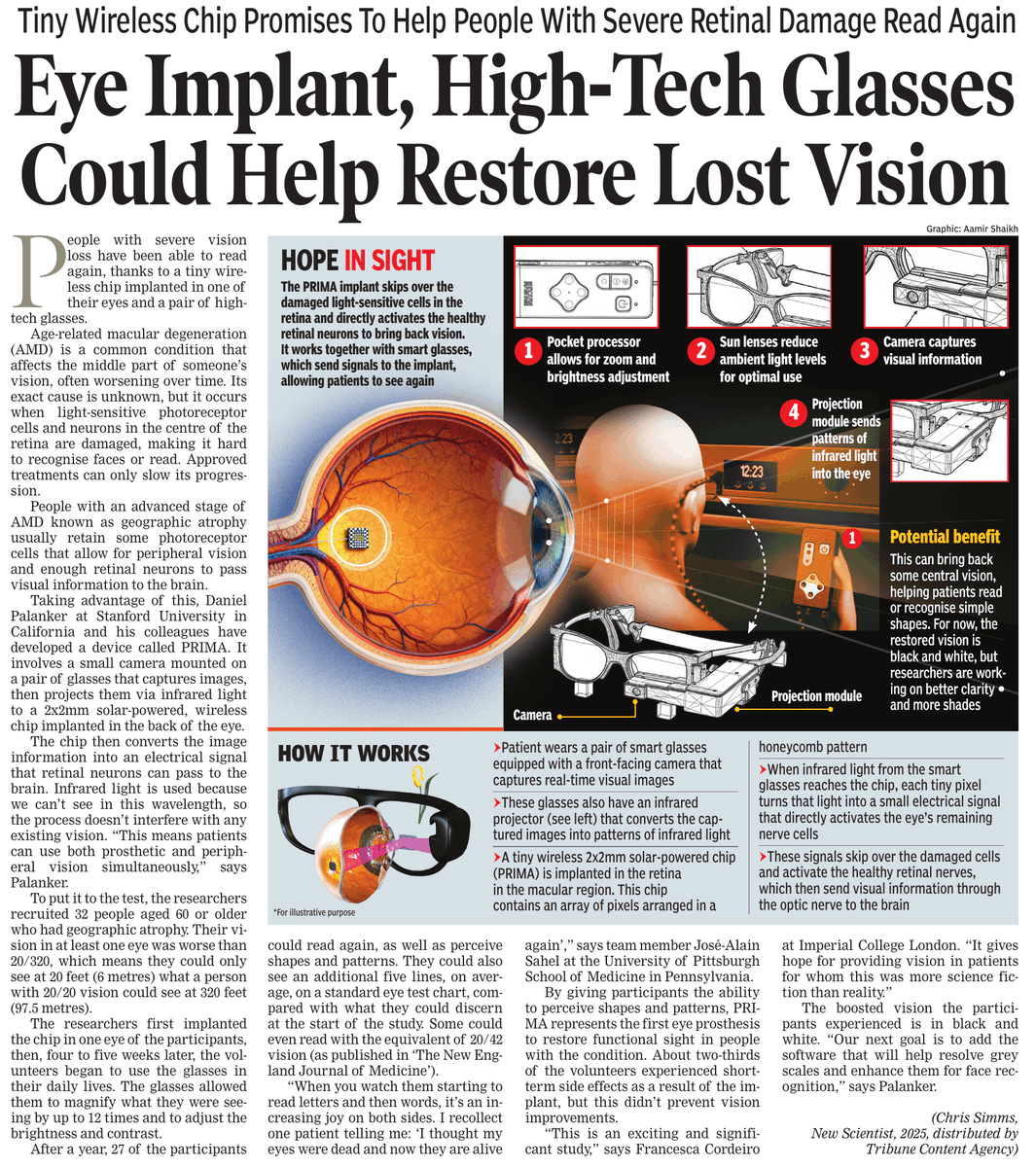 Arv_Ind_Chauhan's tweet image. Hope in Sight.

 Wireless chip promises to help people with severe retinal damage read again