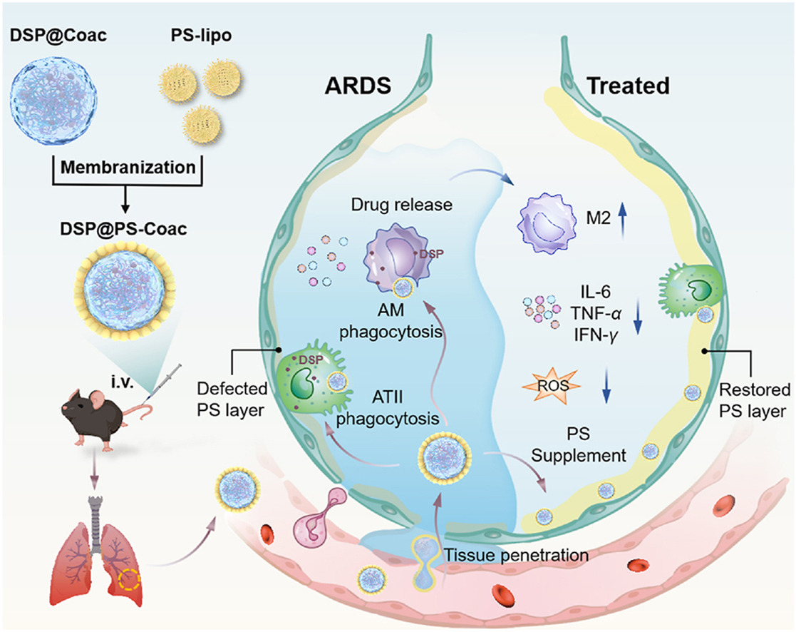 ActaPharmSinB's tweet photo. Article✍️#Pulmonary #surfactant-#biomimetic membranized #coacervate injection for acute #respiratory distress #syndrome therapy. From Dr. Zhang @HuazhongUniversityofScienceandTechnology;
https://t.co/CWHd2dCKcV. https://t.co/gM10ZxwSAp