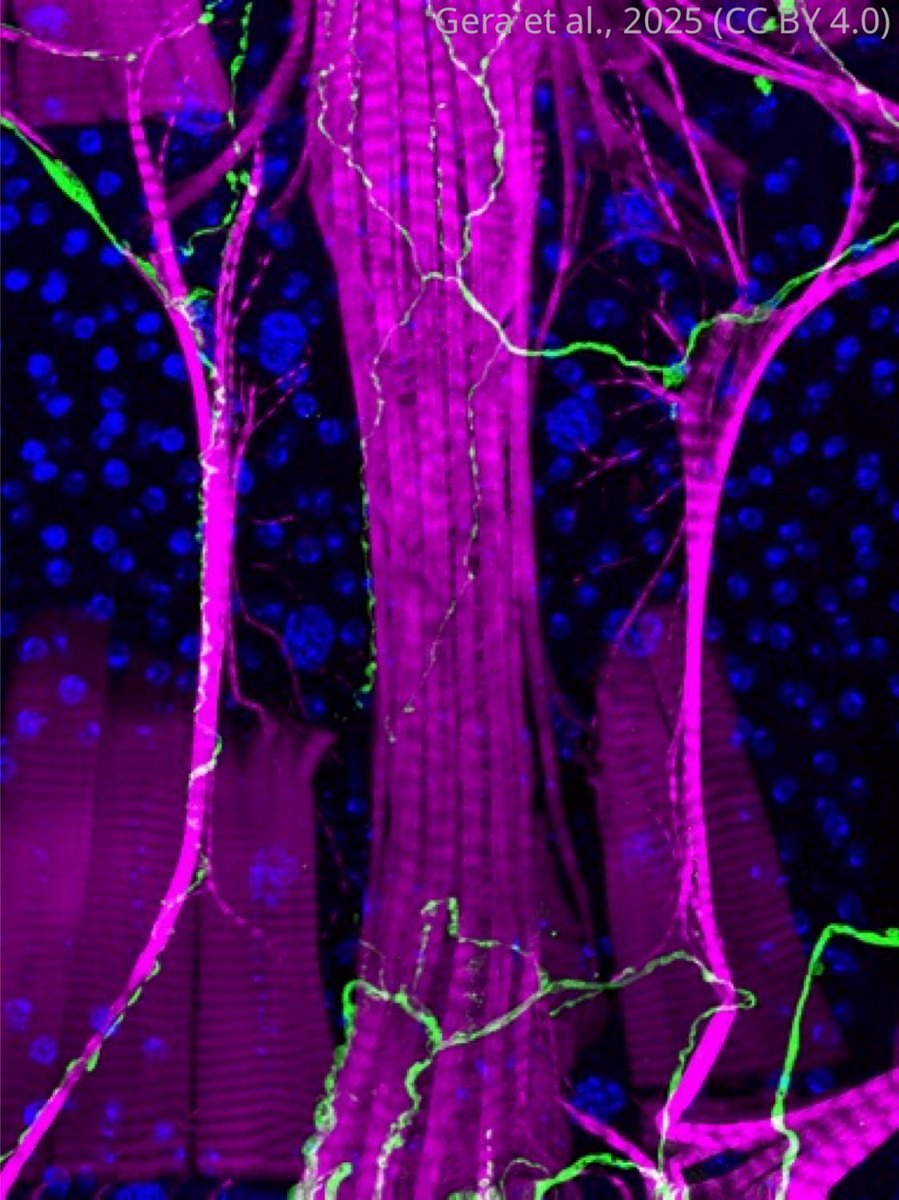 New work reveals Gyc76C as the receptor for the anti-diuretic hormone ITPa in flies, uncovering how it helps control hydration and metabolic balance.
elifesciences.org/articles/97043…