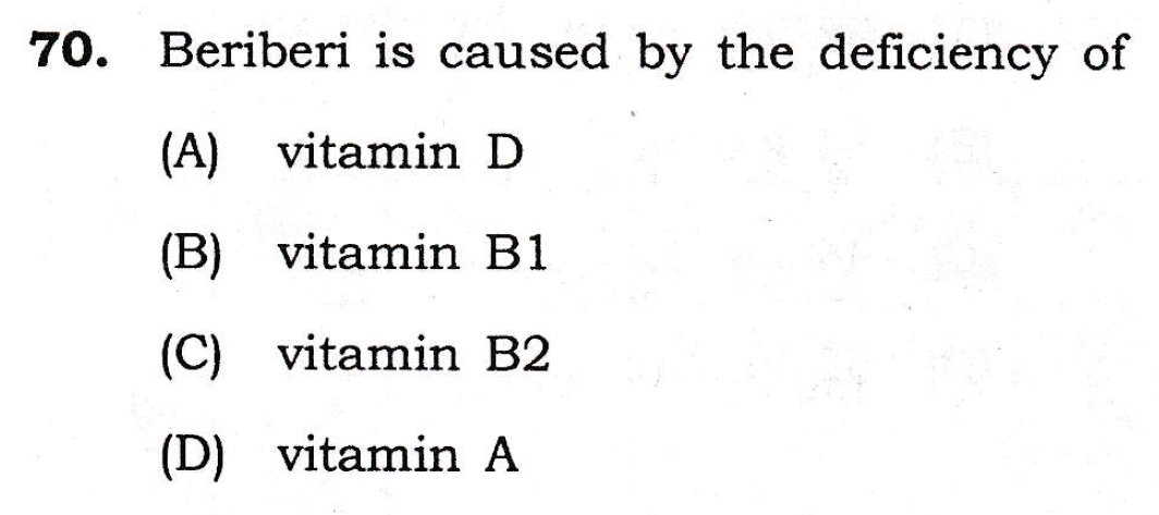 mbtscience's tweet image. 𝐆𝐄𝐍𝐄𝐑𝐀𝐋 𝐒𝐂𝐈𝐄𝐍𝐂𝐄 𝐏𝐑𝐀𝐂𝐓𝐈𝐂𝐄 𝐐𝐔𝐄𝐒𝐓𝐈𝐎𝐍

Beriberi is caused by the deficiency of?

#𝐔𝐏𝐒𝐂 #𝐔𝐏𝐒𝐂𝐏𝐫𝐞𝐥𝐢𝐦𝐬𝟐𝟎𝟐𝟔 #𝐔𝐏𝐒𝐂𝟐𝟎𝟐𝟔 #𝐂𝐀𝐏𝐅 #𝐍𝐃𝐀 #𝐂𝐈𝐒𝐅 #𝐂𝐃𝐒