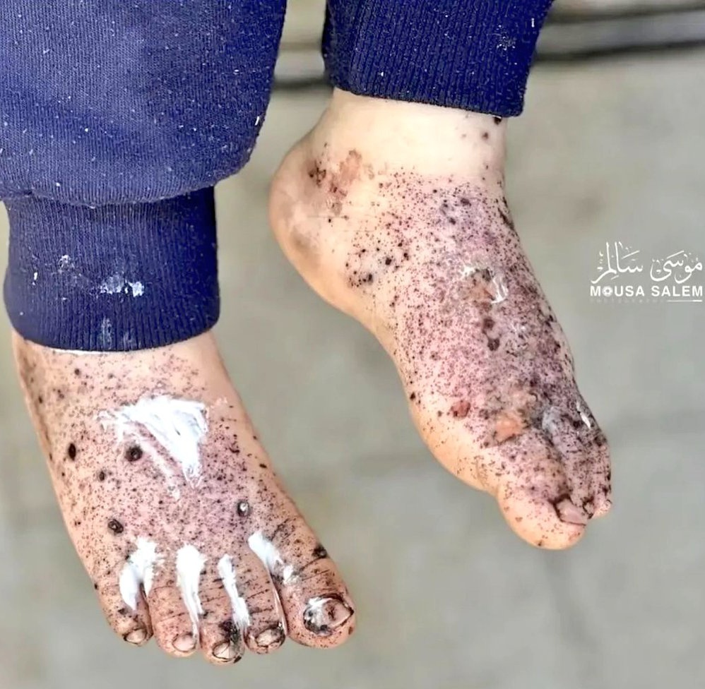 Ros10101's tweet image. No child deserve this.

If you’re scrolling, PLEASE leave a dot.