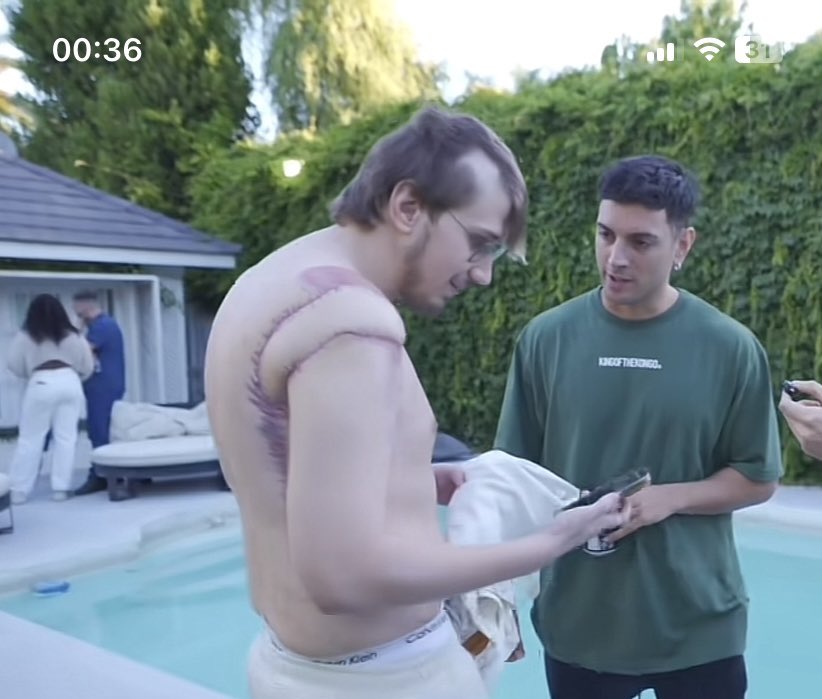 Melisaa171's tweet image. Xq nadie habla de lo q le paso a brunenger???