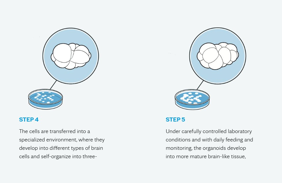 _Celeste_86's tweet image. I&apos;m getting more and more excited about the future of organoid technology! 💡 We can now grow &quot;mini brains&quot; from a patient&apos;s own cells and see in the lab what different drugs might do to their brain ahead of time.
This means — ✔ No more &quot;let&apos;s just try this&quot; treatments ✔…