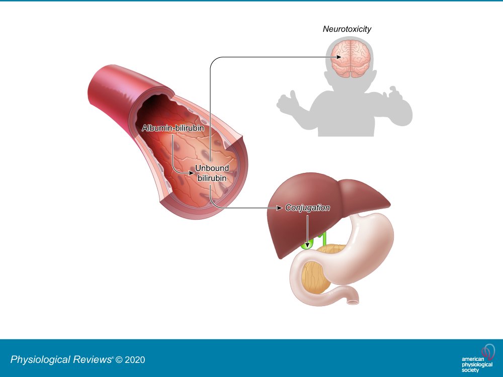 A breakthrough that captures unbound bilirubin before it can harm the body could change newborn care forever.

Read the patent here:worldwide.espacenet.com/patent/search/…

I hope to see some efficacy and selectivity data soon as the topic is fascinating!