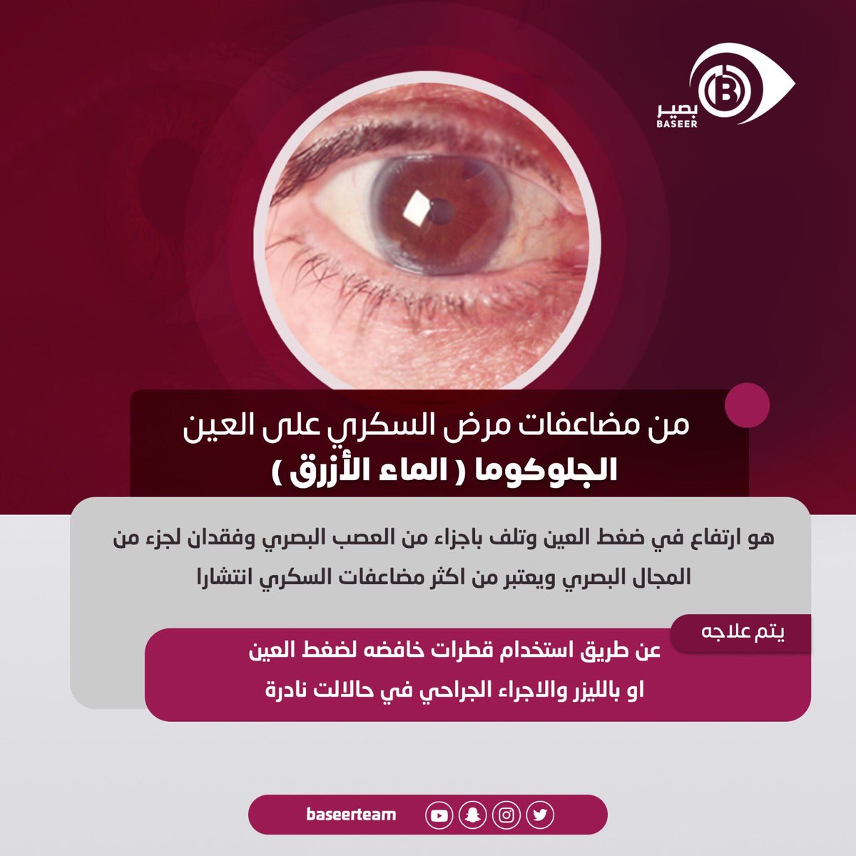 بصير tweet media