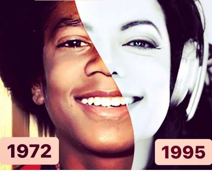 DukeDoggo's tweet image. &quot;But he looks so different!!&quot;
No one looks the same as they did in their early 20s, let alone their teens. Michael&apos;s looks weren&apos;t drastic. Vitiligo, Lupus, his Pepsi burn, and changes in hair, makeup, weight,sleep and stress were all factors.