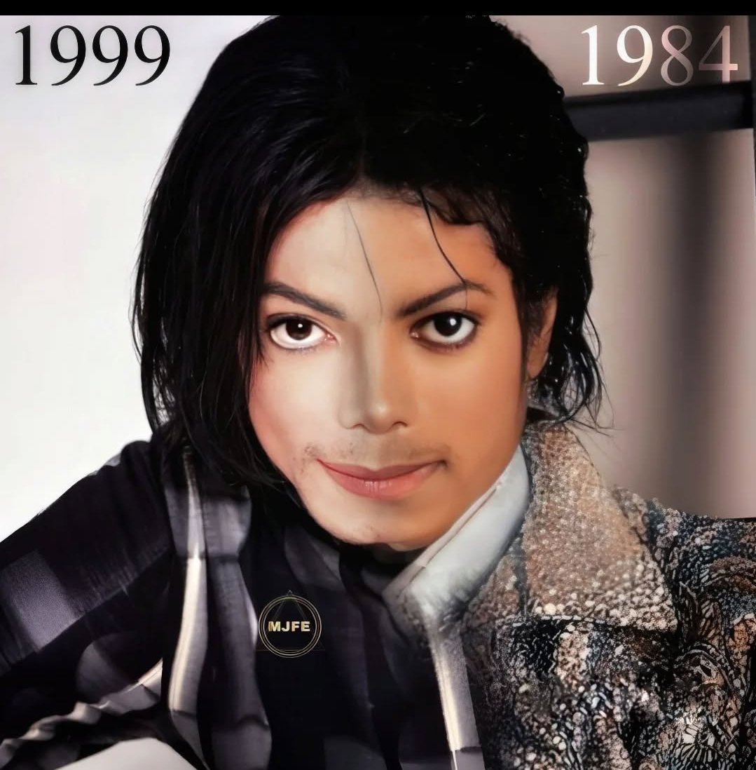 DukeDoggo's tweet image. &quot;But he looks so different!!&quot;
No one looks the same as they did in their early 20s, let alone their teens. Michael&apos;s looks weren&apos;t drastic. Vitiligo, Lupus, his Pepsi burn, and changes in hair, makeup, weight,sleep and stress were all factors.