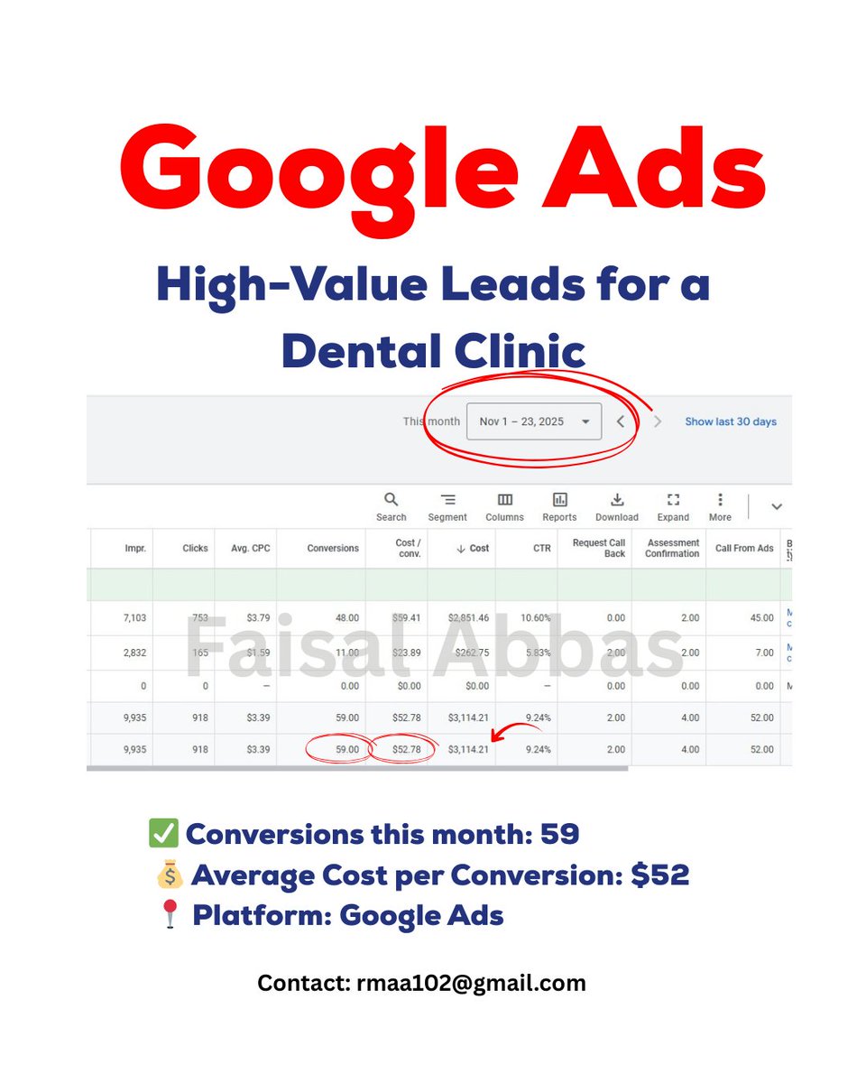 🦷 Case Study: Getting High-Value Leads for a Dental Clinic

Generating leads for porcelain veneers isn’t easy.

Why?

These services are expensive, so potential clients take time to decide.

Competition is high, with many clinics vying for attention.

Quick results are rare -