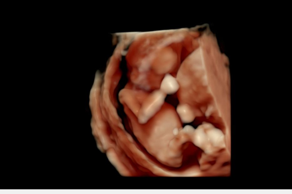 Granddaughter no 3 on the way. So, excited 🩷🩷🩷