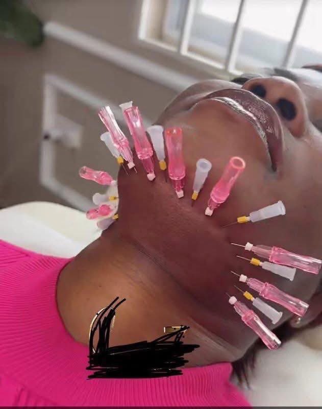 dahtgirl_ajex's tweet image. The pains women endure just to look good for men💔