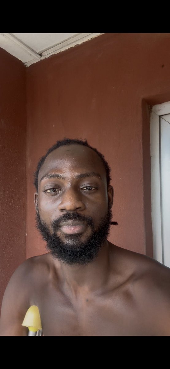 gekyume1021's tweet image. Hey fam quick update 
Surgery was successful, had to get rods drilled into my bones while It heal, the process was quick thanks to everyone involved, Started physiotherapy and in a couple of months to come I&apos;ll be able to use my leg again,
Thank you all for yr prayers and support