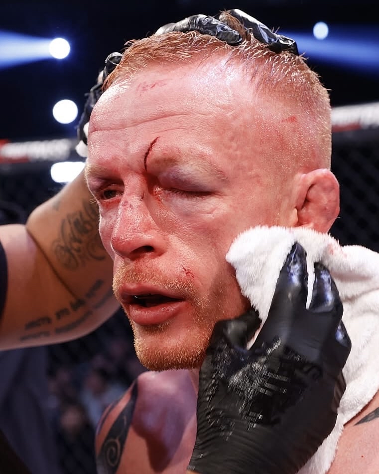 CageWarriors's tweet image. This is what earning a win really looks like. Nothing easy about it. 🩸👏

How about that showing from Tim Wilde at #CW198 Manchester?!