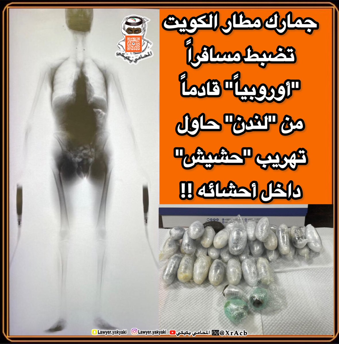 جمارك #مطار_الكويت تضبط مسافراً #أوروبياً قادماً من #لندن حاول تهريب #حشيش داخل أحشائه‼️ 
#المحامي_يكيكي 
#الجمارك 
#فهد_اليوسف_الصباح