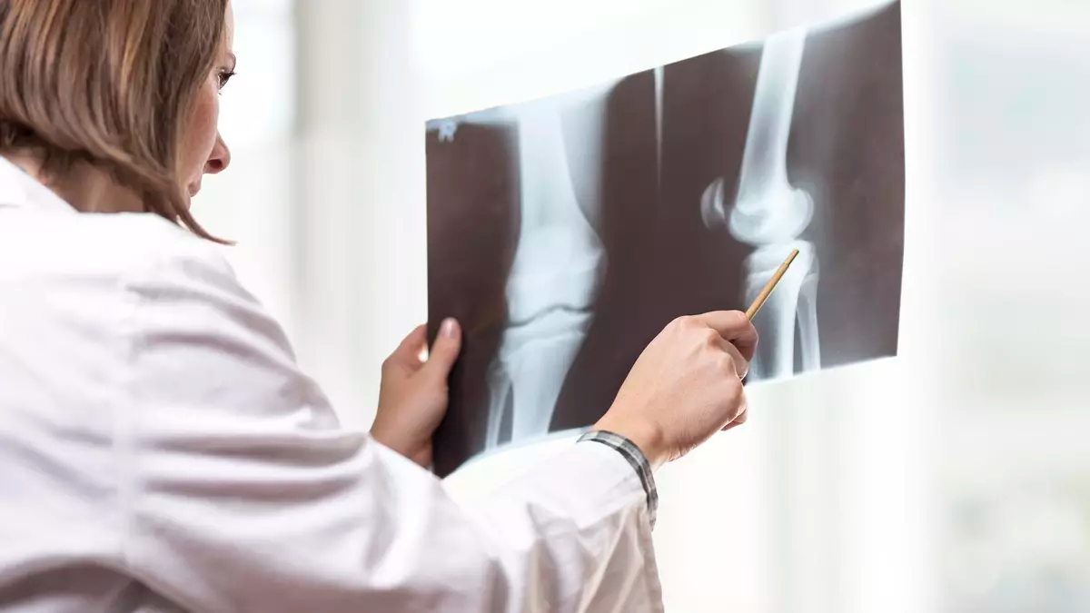 HUReyJuanCarlos's tweet image. ¿Cuál es la tecnología que planifica en 3D las prótesis de rodilla para un ajuste perfecto y natural? El @drdavidsaez, jefe de nuestro Servicio de Cirugía Ortopédica y Traumatología, descubre las características del robot quirúrgico ROSA f.mtr.cool/gceqesdjri vía @eldiarioes