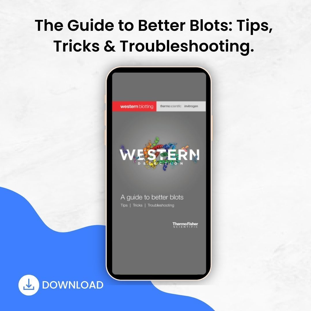 BitesizeBio's tweet image. Improve every step of your #WesternBlot workflow with this free Western Blot Optimization Guide. Get expert tips, troubleshooting charts, and practical advice for clearer, more reproducible results. Download Now → buff.ly/1uN8s8K#Protei… #Proteomics