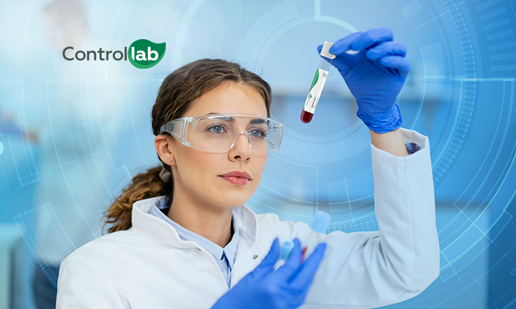 Lab_Network's tweet image. Controllab para todos, qualidade que impulsiona a evolução dos serviços analíticos

As soluções de controle da qualidade da empresa fortalecem a excelência das análises em laboratórios de diversas especialidades, portes e níveis de atuação: labnetwork.com.br/noticias/geral…