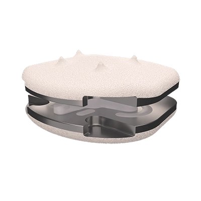 epelgrino's tweet image. Vous ne connaissez pas Spine Innovations ?
Prothèse made in France hors PCU Bionate, lombaire et cervicale.