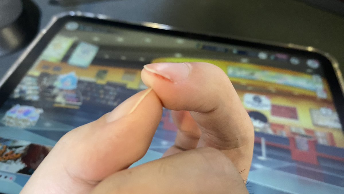 LenmonLu2's tweet image. 很痛QAQ
本日配信一開局沒多久
就被034給gank到
左手慣用指，神中指就這樣嚕到有點皮肉分離滲血

還真是起步即內傷w

還是感謝今天有跟到配信的玩家跟觀眾！此類主題後續會評估，期待下次見！

喜歡可以追蹤訂閱，我們會不定期帶來精彩有趣的音遊主題節目

#台灣VTuber #拎萌路路 #世界計畫 #プロセカ