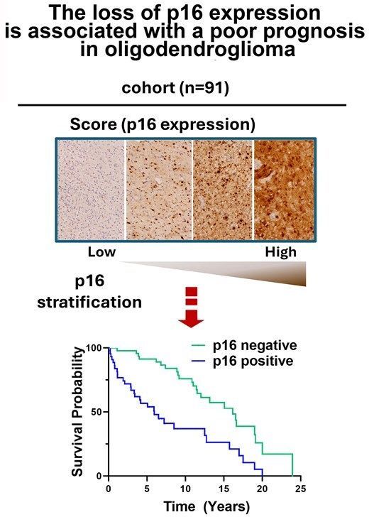 braincomms's tweet image. Vaz-Salgado MA et al. analysed the cyclin pathway, retrospectively in patients diagnosed with oligodendroglioma by the WHO 2021 criteria. Showing that absence of p16 expression is associated with a worse prognosis 👉 buff.ly/OPPcLz7 @mangelesvaz @GrupoGeino @OncoMedRyC